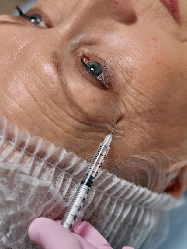 Signature Dental Aesthetics - What Is Lines & Wrinkles Reduction