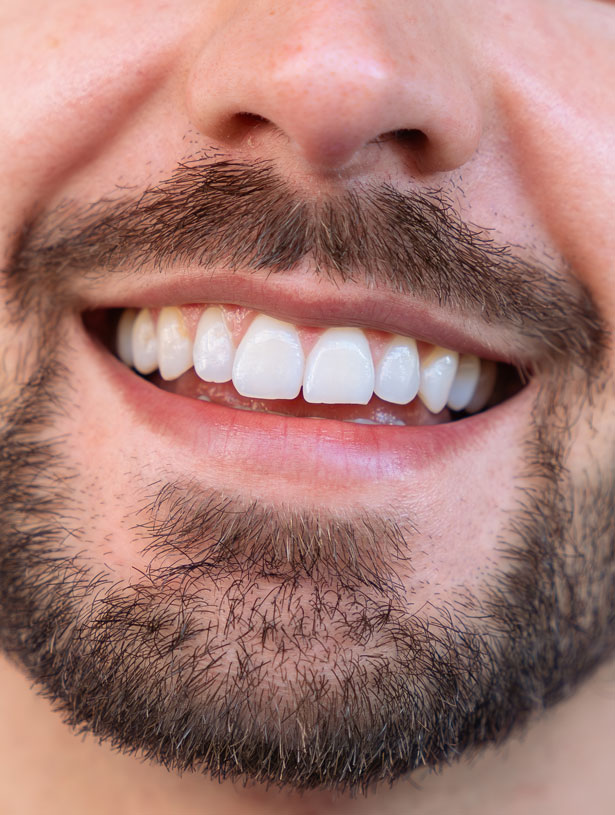 Signature Dental Aesthetics - What Is Scaling & Root Planing