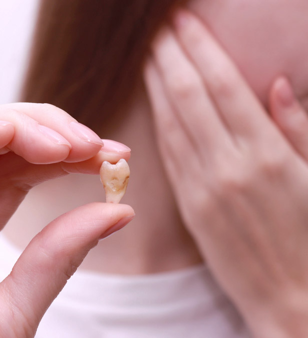 Signature Dental Aesthetics - What Is Wisdom Teeth