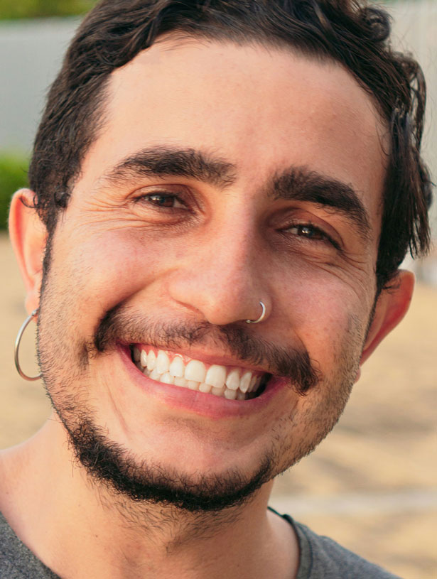 Signature Dental Aesthetics - What is Digital Smile Design