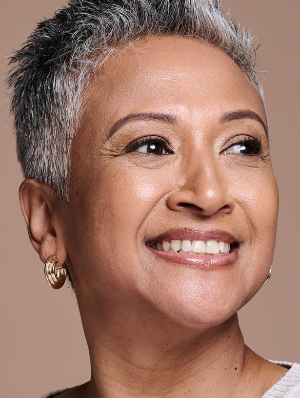 Signature Dental Aesthetics - Why patient choose Full Arch Implants