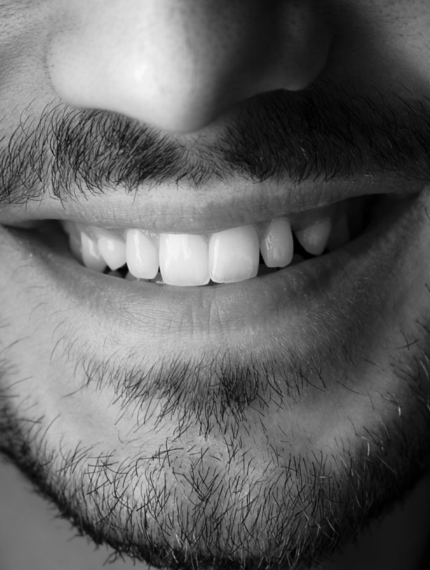 Signature Dental Aesthetics Why patient choose Simple Implants