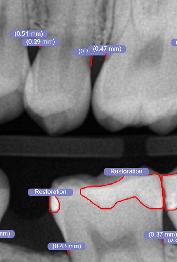 Signature Dental Aesthetics - Better Diagnostics AI Diagnostic Technology